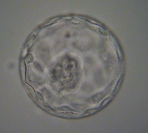 blastocyst culture Why Do I Have Less Eggs Than Follicles?