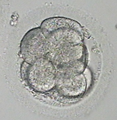 microscope image of embryo on day 3 with 4-8 cells