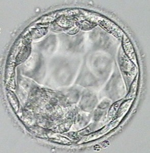 microscope image of expanded blastocyst on day 5