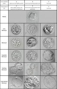 Choosing Embryos For Transfer Or Freezing - Fertility Solutions Is Now ...