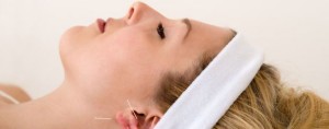 woman with acupuncture needles in ear