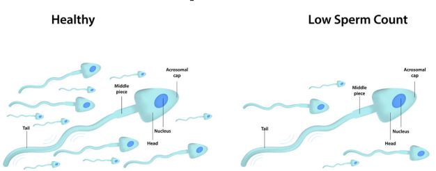 Improve Your Sperm Count And Motility Fertility Solutions Top 6 Tips 