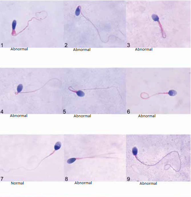 Sperm Morphology Illustration for Fertility Assistance